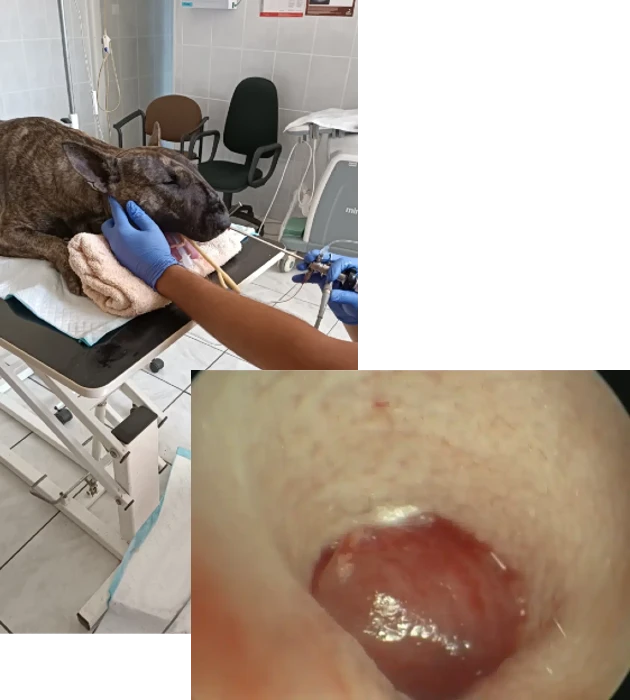 Endoskopia psa